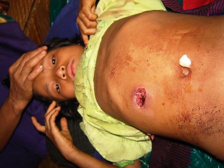 [9 year old, Eh Ywah Paw, Shot March 27 by the Burma Army[1]]